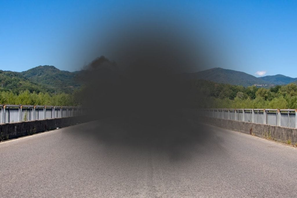 macular-degeneration-loss-of-sight-in-central-vision-zone